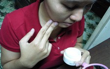 Mụn trứng cá do thuốc