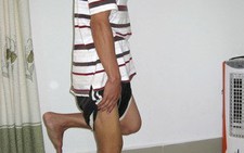Khánh Hòa: đã mổ nội soi gối