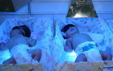 Bệnh vàng da sơ sinh có tái phát?