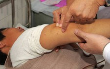Phát hiện virus gây chết hàng chục người trong ve chó