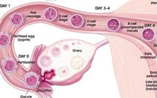 Có dấu hiệu tắc ống dẫn trứng mới chụp HSG