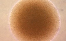 Phát hiện gene chuyển từ người sang vi khuẩn