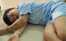 Tạm giữ người bố nghi bạo hành con đẻ