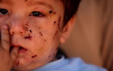 Hãy nói với thế giới rằng dân Syria muốn hòa bình!