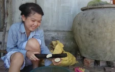 Nụ cười của cô bé lupus ban đỏ