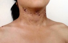 Điều tra vụ tố giác bố đẻ và mẹ kế bạo hành con gái 6 tuổi