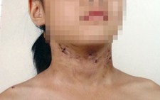 Khởi tố người cha bạo hành con gái 6 tuổi
