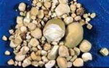 ​Công cụ mới dự báo sỏi thận tái phát