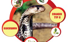 ​Thói quen xấu làm giảm “tuổi thọ” xương khớp