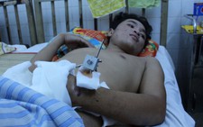 Chàng trai nhà nghèo vừa “vào đời” đã mất bàn tay