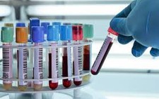 Người Hàn Quốc tử vong tại Thanh Hóa âm tính với MERS- CoV