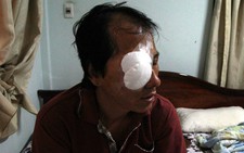 Tuần tra đêm và mật phục để ngăn ném đá xe khách