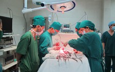 Không chủ quan với u xơ tử cung