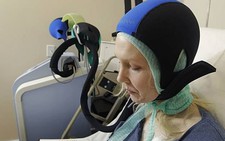 ​Mũ giúp giảm rụng tóc do hóa trị