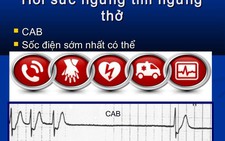Bé gái 9 tuổi ba lần ngưng tim