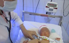 Cứu sống bé sơ sinh bị vỡ dạ dày