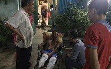 Nổ bình ga trong phòng trọ, hai người bị thương