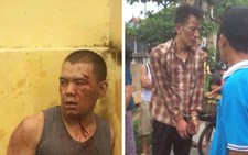Vác kiếm Nhật và rìu đi trộm chó, bị đánh bầm dập