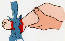 ​Làm gì khi bị bỏng?