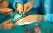 ​Phẫu thuật thắt dạ dày giúp điều trị bệnh tiểu đường tuýp 2