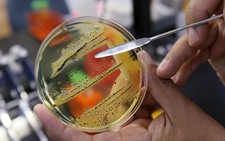 ​WHO công bố danh sách 12 siêu vi khuẩn đáng lo ngại nhất
