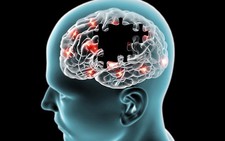 ​Nghiên cứu mới phát hiện nguồn gốc biến đối tế bào ở bệnh Alzheimer