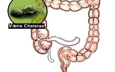 ​Tiêu chảy, một bệnh không nên coi thường