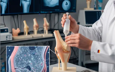 Các nhà khoa học Đức phát triển gel tái tạo sụn khớp mới?