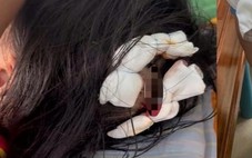 Công an làm việc với người cha dượng liên quan đến bé gái lớp 5 nghi bị bạo hành
