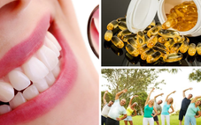Bất ngờ: Omega-3 và tập thể dục giúp ngăn viêm răng và tiêu xương