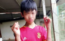 Nam sinh bị nhóm bạn đánh bầm tím trên đường đi học về, trường đang xác minh