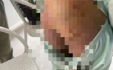 Khởi tố người phụ nữ và bạn trai bạo hành bé gái 9 tuổi ở TP.HCM