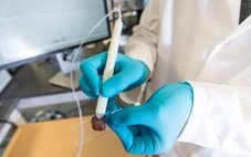 Thiết bị phát hiện được ung thư chỉ trong 10 giây