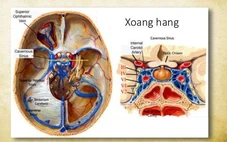 Ngạt mũi, đau đầu, thanh niên 25 tuổi nhập viện vì nhiễm trùng sọ