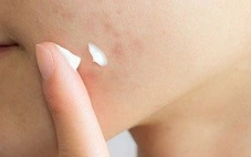 Thu hồi 46 loại mỹ phẩm trên toàn quốc