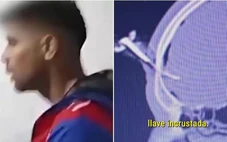 Cầu thủ Argentina nhập viện vì bị đâm chìa khóa xe xuyên qua hộp sọ