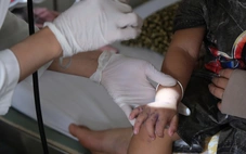 Bệnh tay chân miệng tăng nhanh ở nhiều tỉnh thành miền Tây