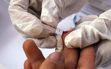 Bệnh nhân than trời vì bốn ngày xét nghiệm máu 3 lần