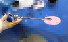 Bác sĩ cảnh báo xu hướng đáng lo gia tăng ở nhóm trẻ gái 10-16 tuổi