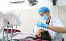 Bác sĩ cảnh báo sâu răng gia tăng ở người niềng răng