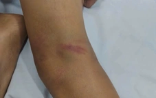 Công an xác minh video người đàn ông xô ngã xe đạp điện, quất cây liên tục vào 3 cháu bé