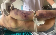 Học viên bị đánh chết sau 2 ngày nhập học: Tạm dừng hoạt động trung tâm công tác xã hội