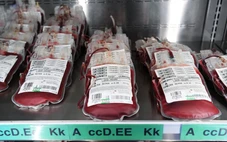 Nhóm máu liên quan đến nguy cơ mắc ung thư dạ dày