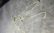 Rùng mình thấy sán lợn dài gần 10m ký sinh trong cơ thể bệnh nhân 37 tuổi