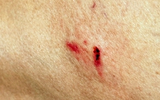 Nhiều người ở Đồng Nai bị khỉ hoang tấn công khi đang ở trong phố