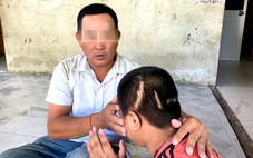 Vụ học sinh lớp 3 bị xe tông tổn thương 90%: Người giao xe có phải chịu trách nhiệm?