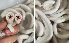 Bé 10 tháng tuổi tử vong, trong máu có nồng độ cồn; lòng se điếu hiếm nhưng bán đầy thị trường