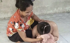 Vụ học sinh lớp 3 bị tông chấn thương sọ não: Ai chịu trách nhiệm bồi thường?