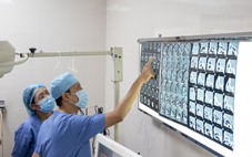 Hàng xóm dùng đũa nhựa đâm vào mắt, nhãn cầu phải của bệnh nhân bị biến dạng nặng