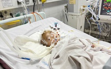 Cháu bé bị xuất huyết não ở điểm giữ trẻ tự phát, công an vào cuộc